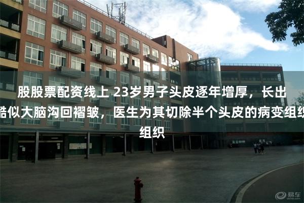 股股票配资线上 23岁男子头皮逐年增厚，长出酷似大脑沟回褶皱，医生为其切除半个头皮的病变组织